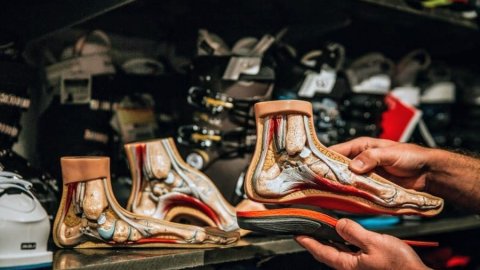 type de pieds pathologiques